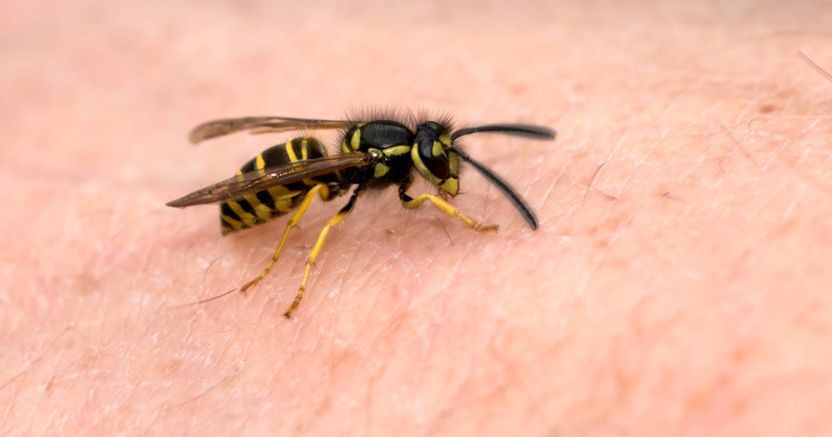 Share 119 Yellow Jacket Bee Sting Reaction Latest Vn